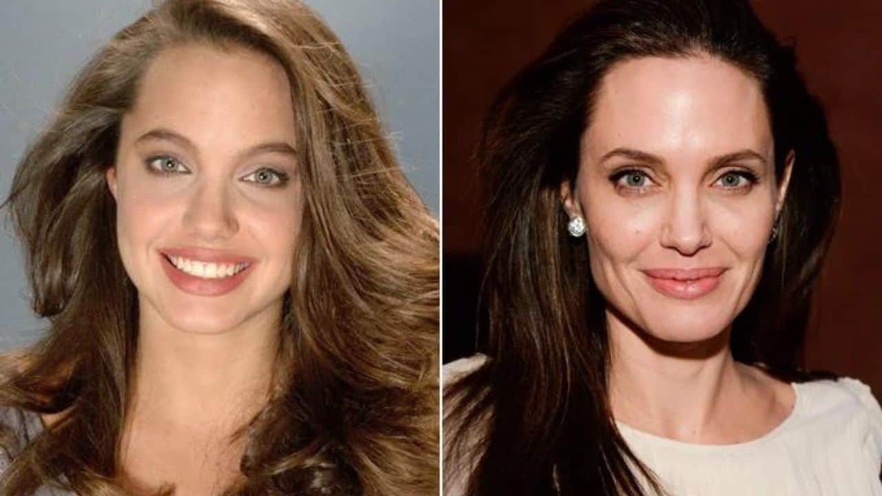 Angelina Jolie Before And After Plastic Surgery Journey