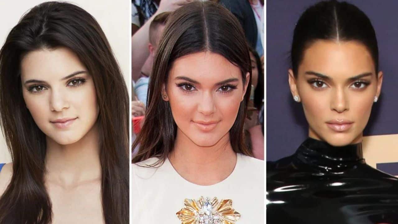 Kendall Jenner Plastic Surgery Before And After Photos 9543